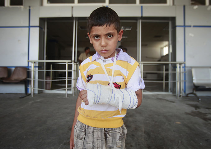 Libya: Boy with broken arm in Zawiyah