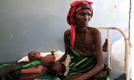 A Somali woman with her malnourished child in a Mogadishu hospital