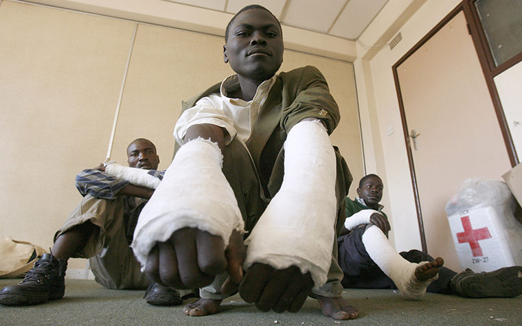 Robert Mugabe: May 2008: Opposition party MDC supporters show their injuries