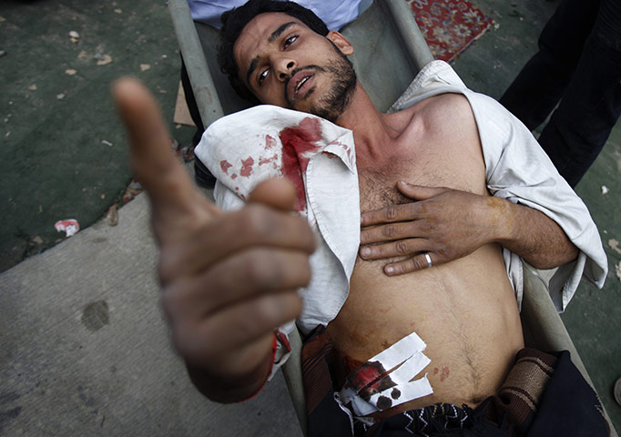 yemen : injured anti-government protester 