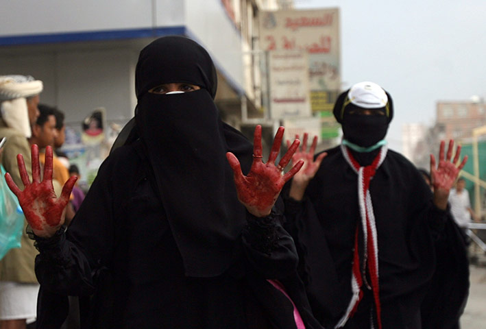 yemen : Anti-government protesters women show blood on their hands