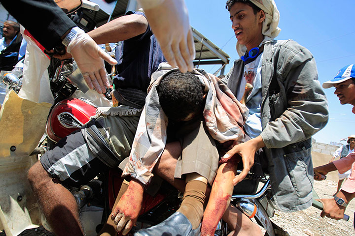 24 hours in pictures: Wounded anti-government protester is carried onto a motorcycle in Sanaa