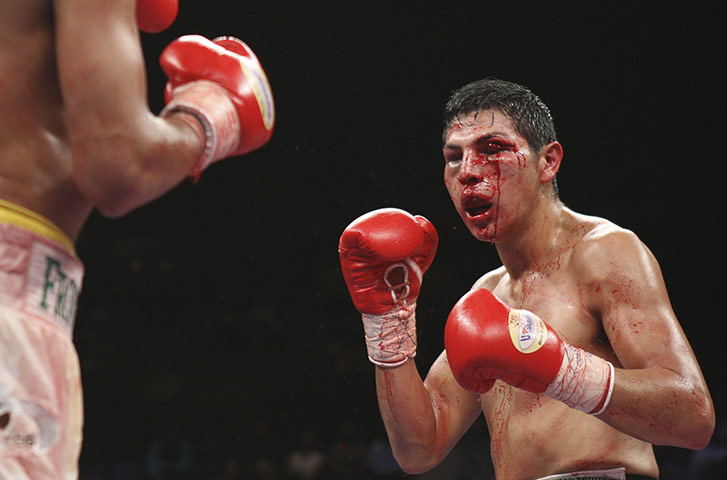 Pix of the week: Cesar Cano of Mexico bleeds from a cut above his eye