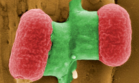 Unpublicised E coli outbreak leaves 250 ill and one dead E-coli-bacteria-under-an--008
