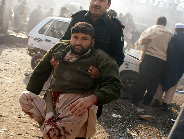 Pakistan bombing: injured man