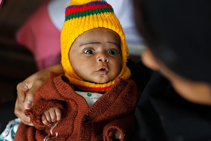 Polio vacination: An infant looks at his mother as they wait for his first polio vaccination