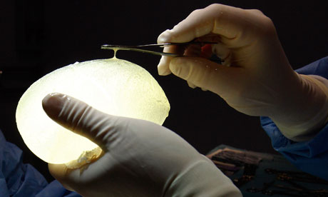 Defective breast implant