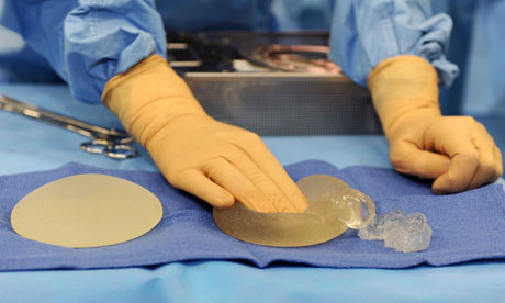 Breast Implant Removal Surgery, Saint Joseph Hospital, Paris, France - 05 Jan 2012