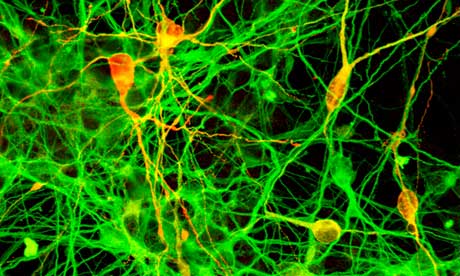 Dopaminergic neurons