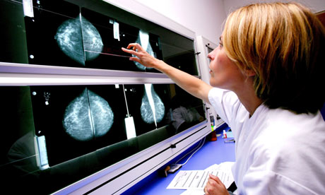 Breast cancer screening: a radiologist examines mammograms on a lightbox