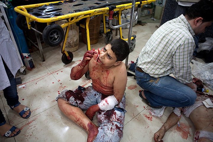 FTA: Maysun: A child covers his wounds after he was injured by a Syrian army sniper