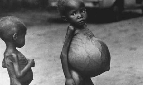 Biafran CHILDREN STARVING.