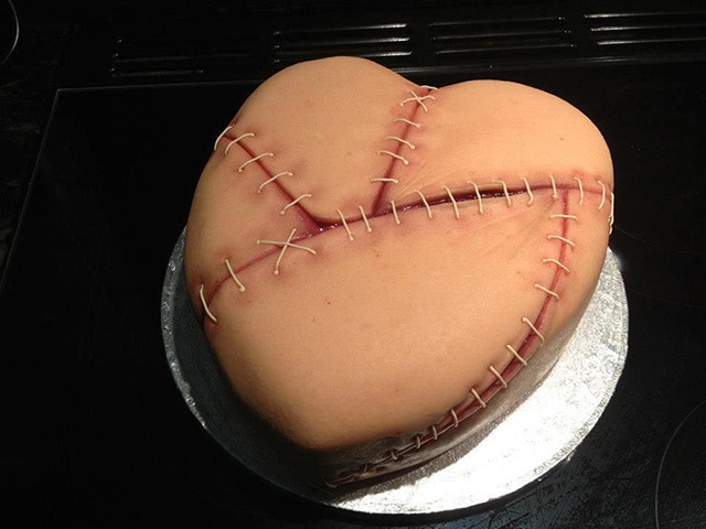 Gruesome cakes: Stitched skin cake