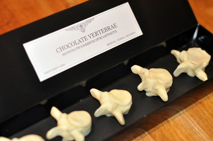 Gruesome cakes: Chocolate vertebrae in a box