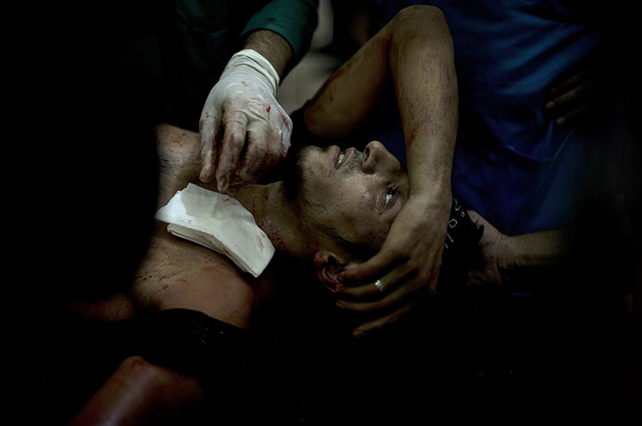 20 Photographs: A Syrian rebel fighter is brought to the Dar al-Shifa hospital in Aleppo
