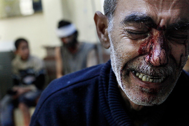 24 hours in pictures: A father cries while his children are being treated in a local hospital