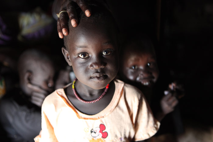 Malaria Consortium: Four-year-old Nyatini Muut Tora receives preventative trachoma antibiotic