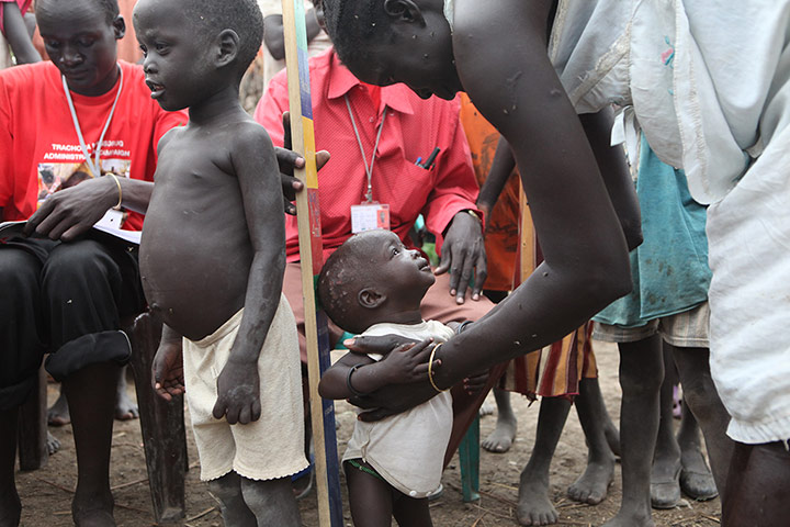 Malaria Consortium: Mary Nyekuich Jak helps her youngest daughter