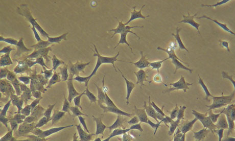 Cancer cells