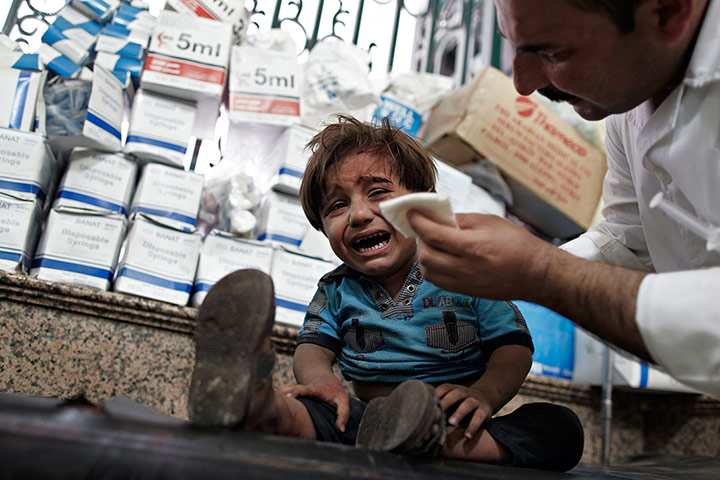 24 hours: Aleppo, Syria: Wounded by shrapnel, a child is treated in hospital