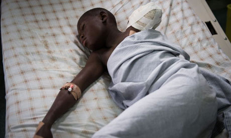 A boy, 12, lies in a Goma hospital after losing his arm to amputation