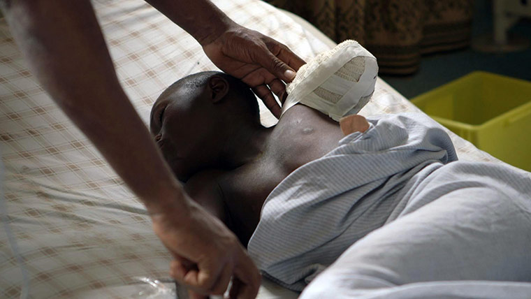 Goma fighting: A young boy who lost his arm yesterday when a mortar went off next to him