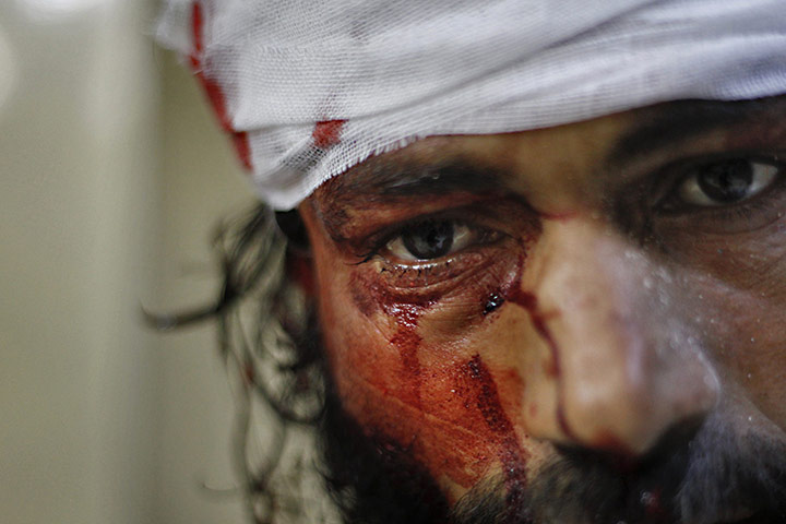 Twenty Photos: A man is treated after a Syrian government forces jet attacked in Aleppo