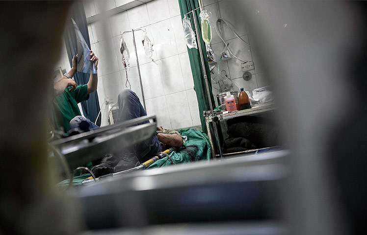 From The Agencies: An injured rebel receives emergency medical assistance at a hospital