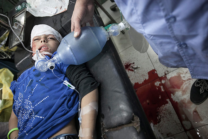 From The Agencies: An 8-year-old Syrian girl struggles for life in hospital