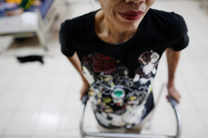 24 Hours: Lopburi, Thailand: A patient makes her way through a hospice