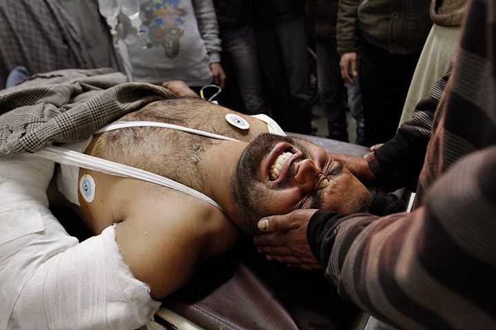 24 hours in pictures: An injured Kashmiri man