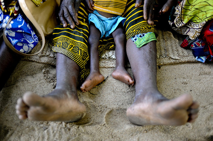 Monitoring malnutrition : Save the Children in Mozambique