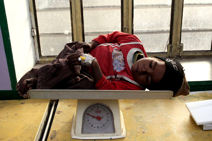 Monitoring malnutrition : Save the Children in India