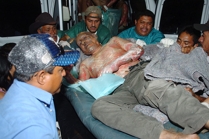 Honduras prison fire: A wounded man is carried on a stretcher at Escuela hospital in Tegucigalpa