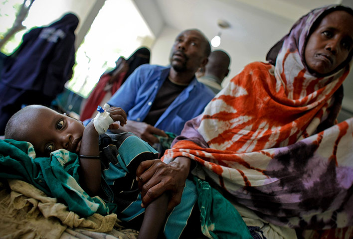 Somalai timeline: a malnourished and dehydrated young child in Banadir Hospital