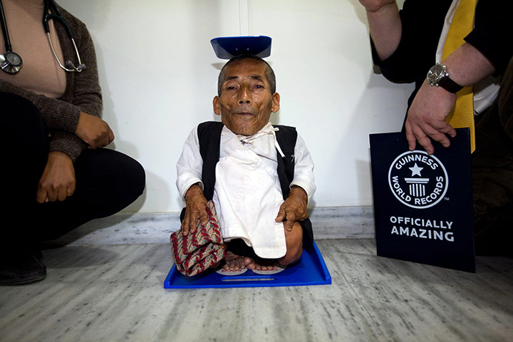 World's shortest man: Dangi goes through a final height verification process at CWIC hospital