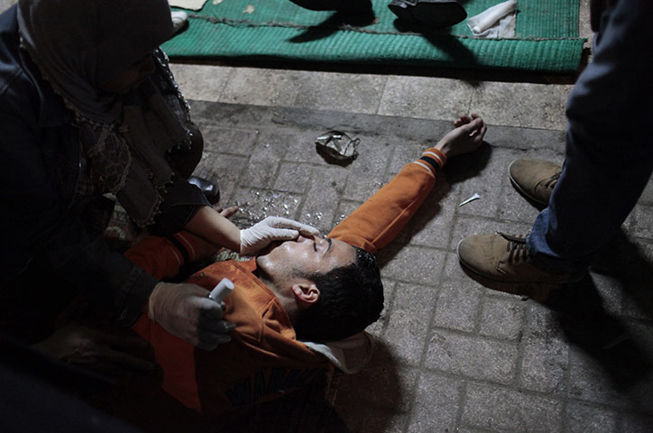 24 hours in pictures: A protester suffering from the effects of tear gas inhalation, Cairo