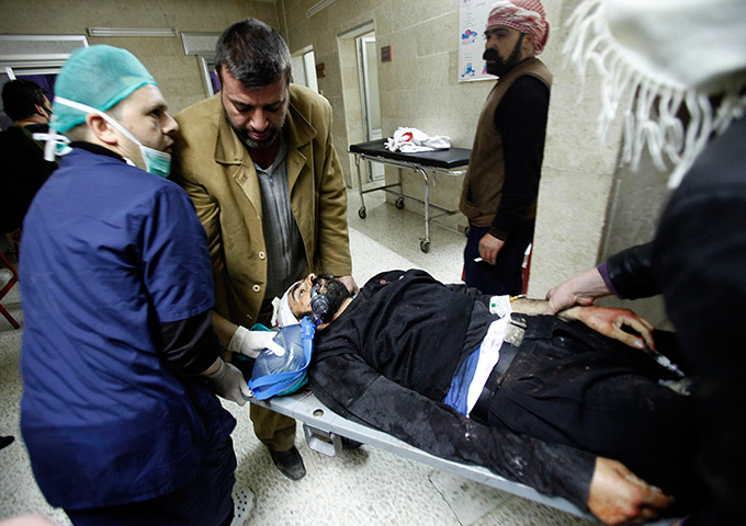 24 hours in pictures: Idlib, Syria: An injured rebel fighter