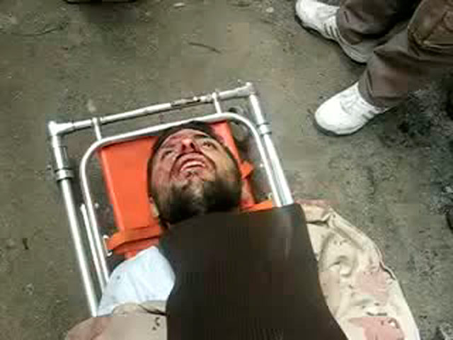 Syria Update: Victim evacuated from a bombed area in  the summer resort of Zabadani