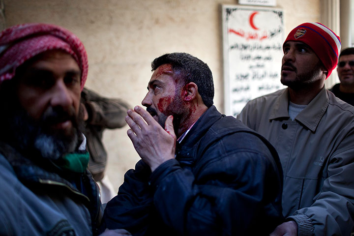 Syria Annan: An injured man arrives at a hospital in Idlib, Syria