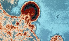 HIV virus