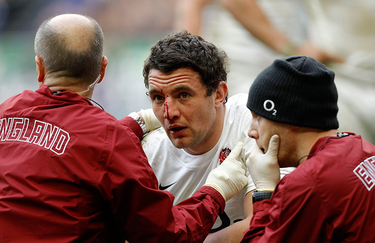 sport ----: England's Dowson