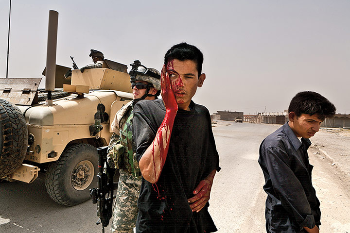 Sean Smith open weekend: Two boys injured by an IED