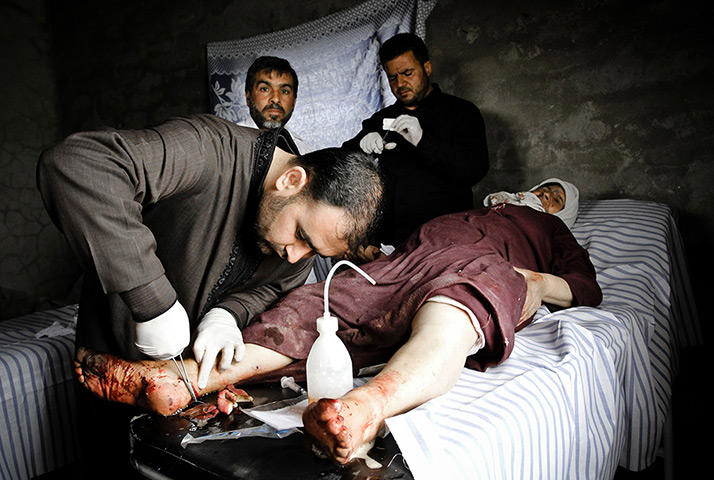Aleppo, Syria: A doctor works on a woman's foot after she was injured by tank shelling