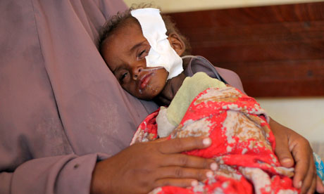 Starving child in Kenya