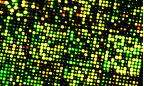 Micro array DNA chip