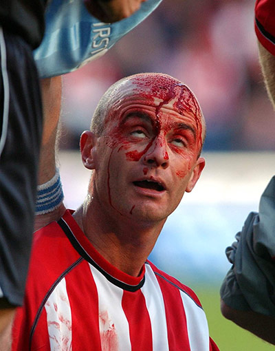 Barclays photo awards: Southampton's Chris Marsden bleeding from the head and eyes rolling