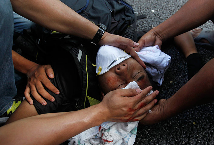 Kuala Lumpur: An injured protester