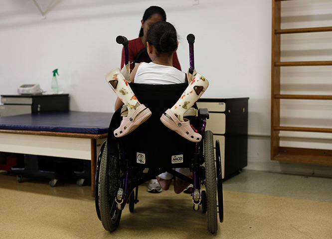 24 hours in pictures: The prosthetic legs of Yara Santos hang from her wheelchair