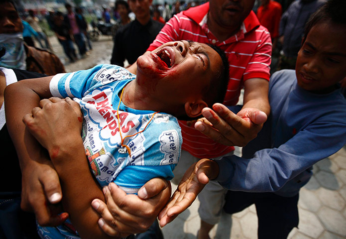 Picture Desk Live: Boy, who was injured during a protest in Nepal